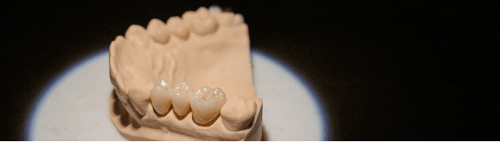 Постоянные конструкции: красиво, надёжно, надолго