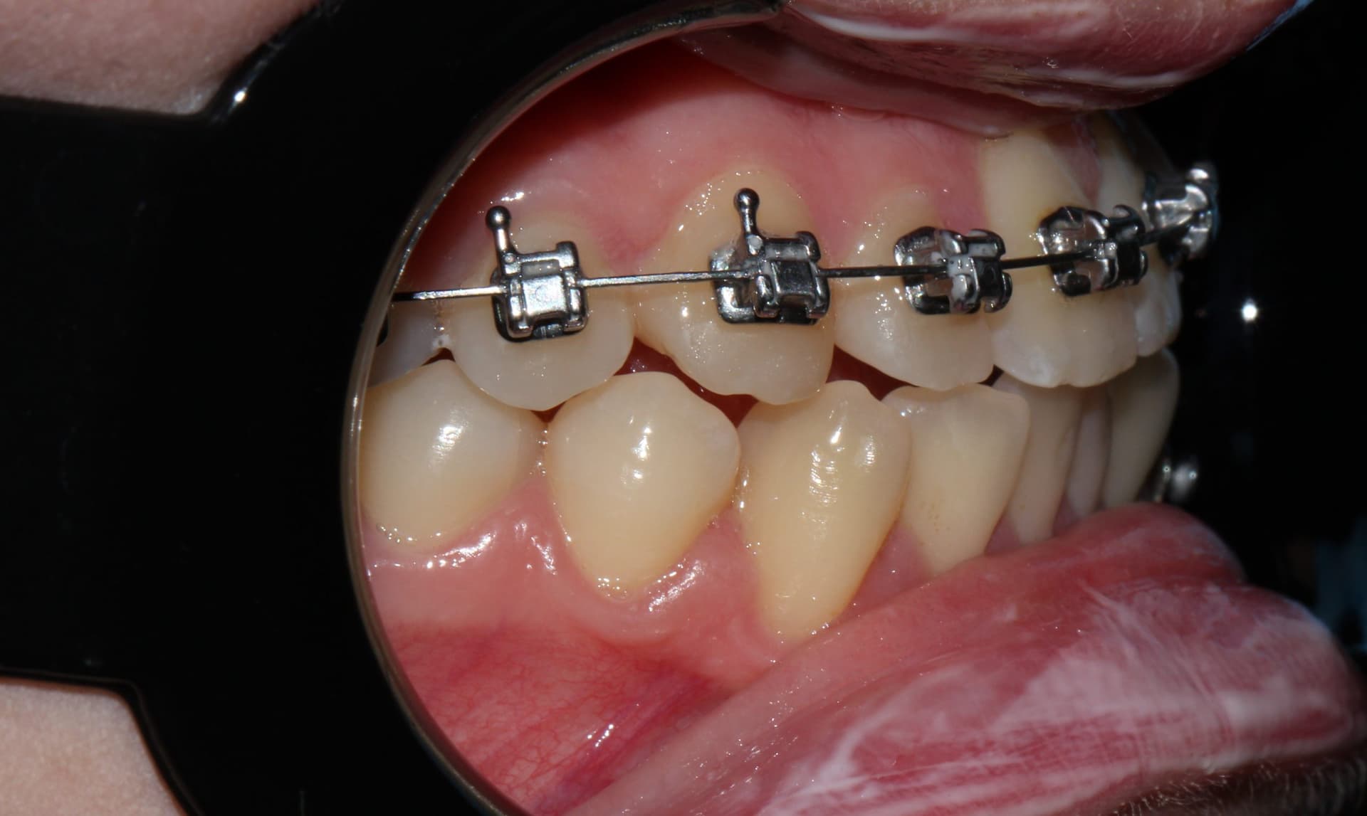 Промежуточный результат