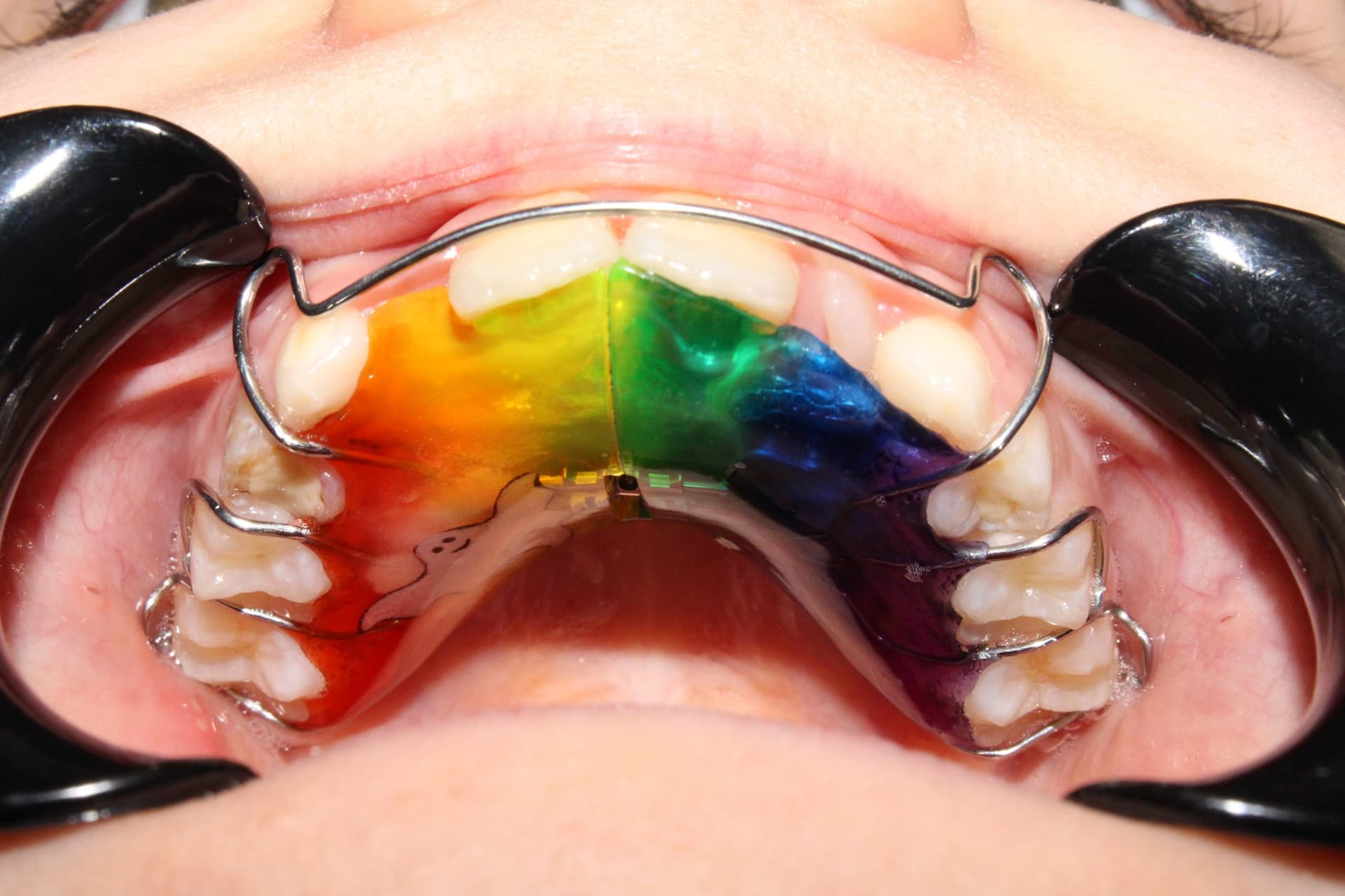 После установки