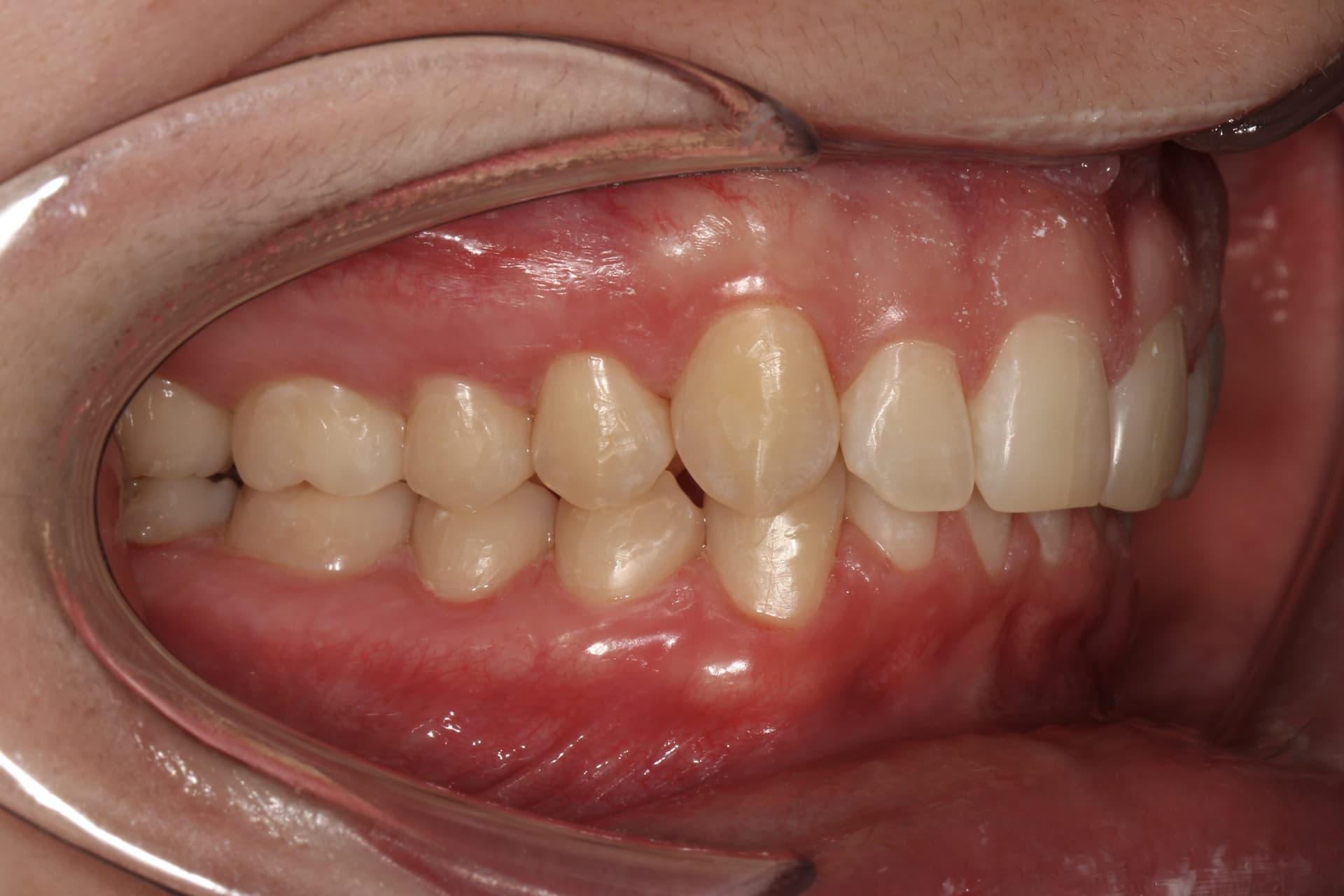 Динамика за 9 месяцев