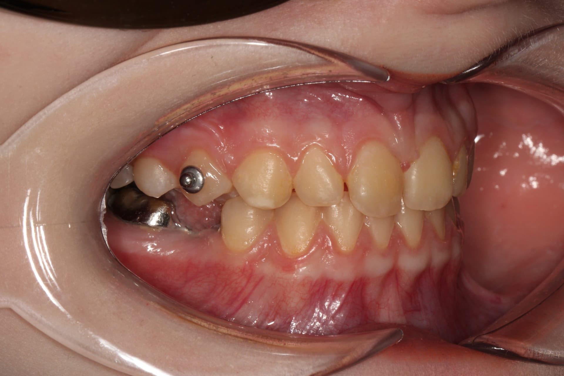 На этапе лечения