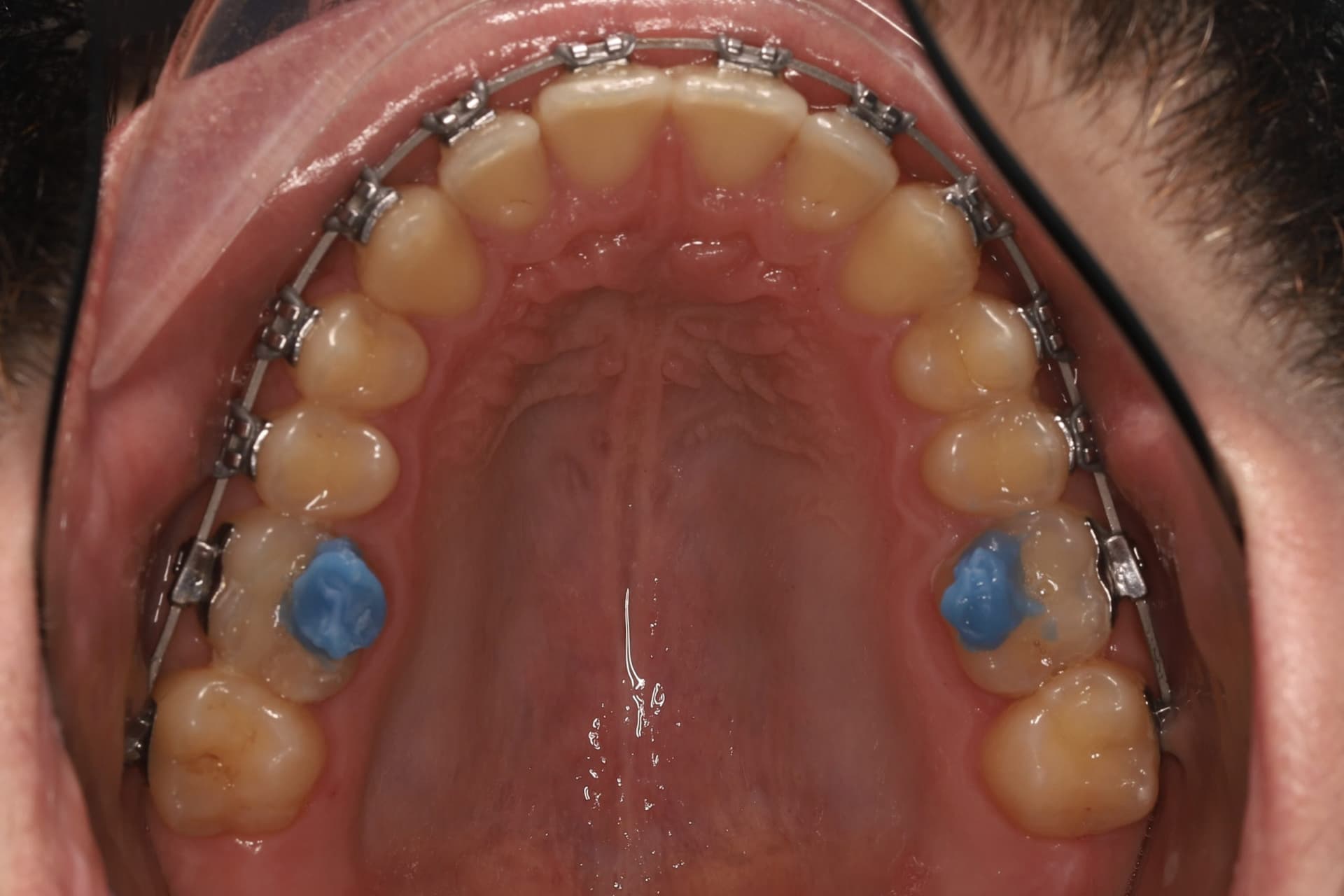 На этапе лечения